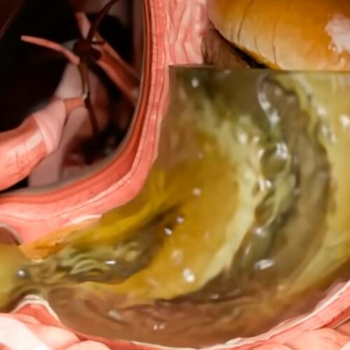 Ozempic Exposed: The Shocking Side Effects Your Doctor Won’t Tell You—Is This the Jab Your Body Secretly Regrets?