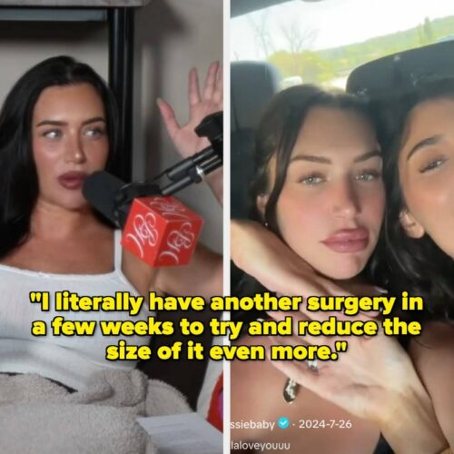 Stassie’s Shocking Midlife BBL Crisis: Why Reversing Her Curves at 23 Has Everyone Talking (And No, It’s Not Just Karma)