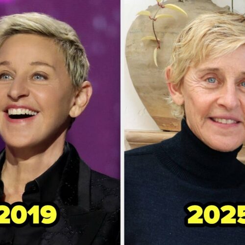 Celebs Dumping Fillers: The Wild Reasons They Ditched the Puff and What Astrology Says About Their Bold Moves!
