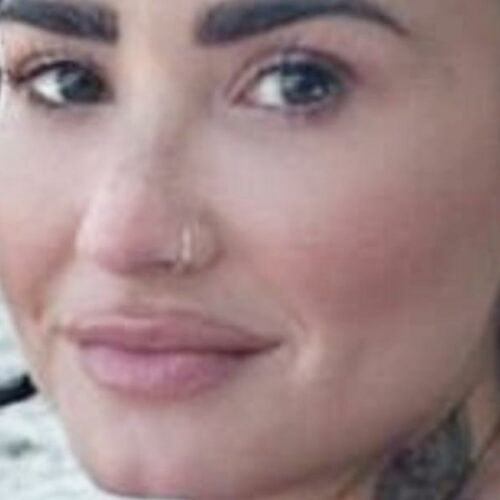 Demi Lovato’s Bikini Thigh Gap Sparks Poolside Mystery—What’s Really Going On Beneath the Surface?