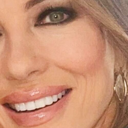 Elizabeth Hurley’s Braless Minidress Has the Internet Divided—Is This Bold or Just a Fashion Crime of Cosmic Proportions?