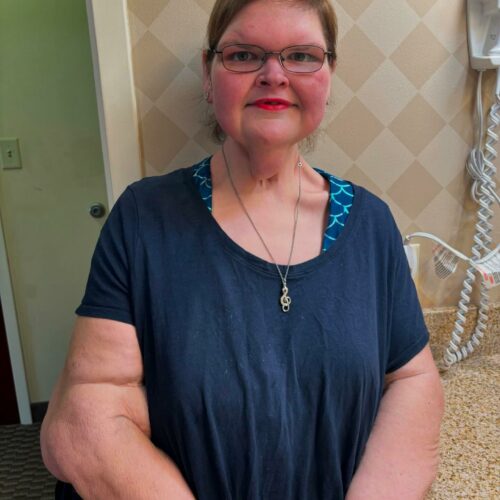 Hold Onto Your Horoscope: Tammy Slaton’s Jaw-Dropping Skin Removal Reveal Has Fans Shook—Is This the Transformation Mars Ordered?