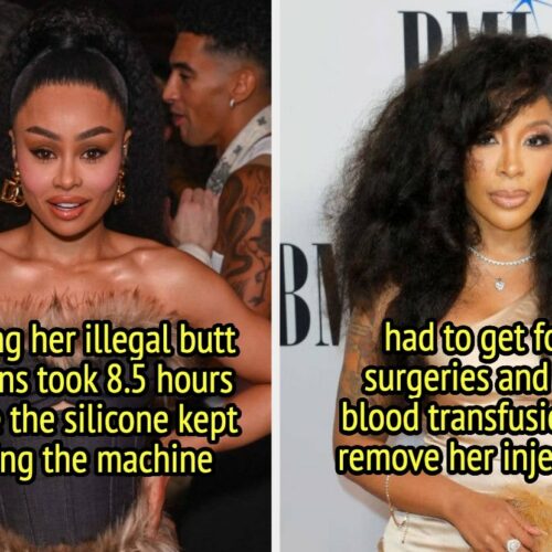 13 Celebrities Who Went Under the Illegal Knife—and Lived to Regret Every Single Decision (Spoiler: It’s Not Pretty)