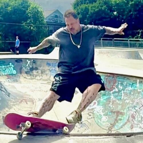 Bam Margera’s Shocking Leg Horror: How His Limbs Nearly Turned Into Science Experiment Gone Wrong!