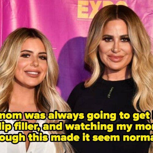 Brielle Biermann Drops a Cosmetic Bombshell: Why Fillers Are Her New “Diet Coke” Addiction You Didn’t See Coming
