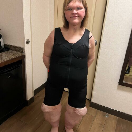 Tammy Slaton’s Jaw-Dropping Glow-Up After Skin Surgery Has Fans Asking: Who’s This New Star in the Mirror?