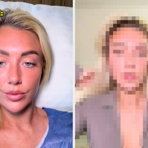 This "Love Island" Star Took Fox Eye Surgery To The Next Level—Wait Till You See The Jaw-Dropping Reveal That’s Got Astrologers Buzzing!