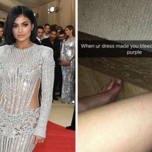 16 Red Carpet Disasters: When Celebs Proved Just How Much “Pain” Beauty Can Really Inflict (Warning: You’ll Cringe)
