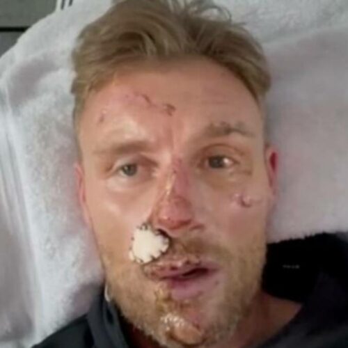 Freddie Flintoff’s Near-Death Top Gear Crash: The Shocking Truth He’s Been Hiding All Along!