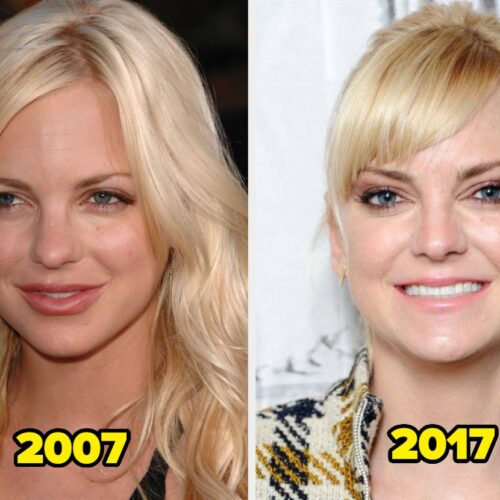 17 Celebs Who Said “Bye, Botox!”—And the Shocking, Hilarious Reasons They Ditched Fillers for Good