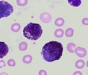 Cromolyn, Mast Cells, and Neck Drama: The Unexpected Twist That’ll Make You Rethink Everything You Thought You Knew!