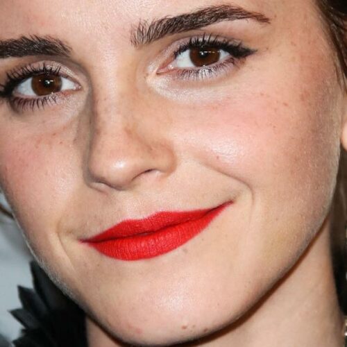 Emma Watson’s Leggy Look Has Fans Buzzing—But What’s Up With Those Mysterious ‘Bruises’?