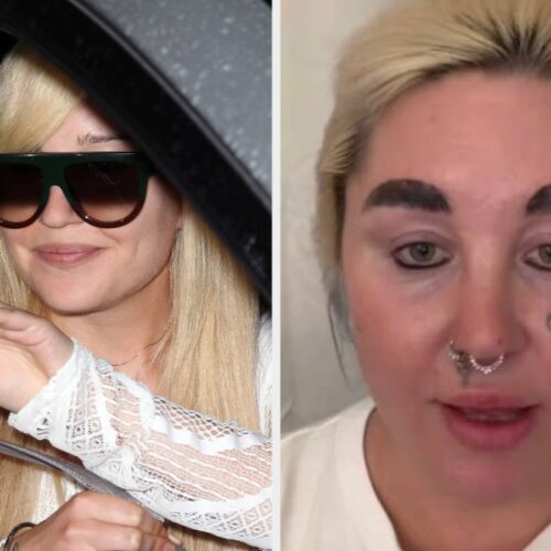 Amanda Bynes Drops Ozempic Tea After 5 Months—You Won’t Believe What She Revealed Next!