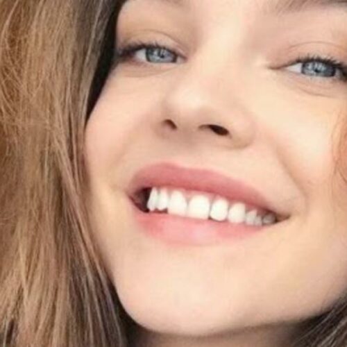 Barbara Palvin Drops Glitter Bomb, But Did That Plunge Reveal More Than Just Sparkles?