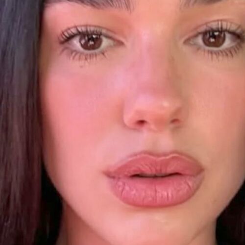 Dua Lipa’s Bikini Slip Sparks Galactic Buzz—Are Her ‘Melons’ Aligned With Your Horoscope?