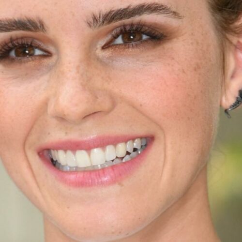 Emma Watson’s Bikini Bottom Stuns Italy—Is This Her Secret to Cosmic Confidence or Just Summer Sass?