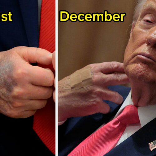 Is Trump’s Hand Hiding a Secret? A Month-By-Month Visual Deep Dive You Didn’t See Coming in 2025!