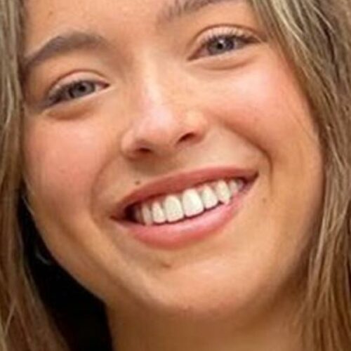 Kelly Ripa’s Daughter Drops Bikini Bombshell—Asks the Internet Why Her ‘Legs’ Are Suddenly ‘Open’ and We Can’t Look Away!