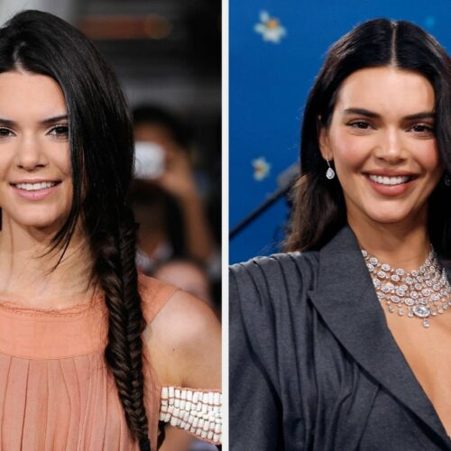 Kendall Jenner Caught in Botox Battle: Did She Just Spill the Truth or Mastermind the Biggest Beauty Bluff Ever?