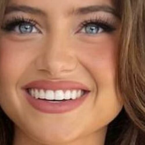 Heidi Klum&rsquo;s Daughter Sparks Social Media Frenzy with Bikini Reveal &mdash; But What&rsquo;s REALLY Up with That Question About Her Chest?