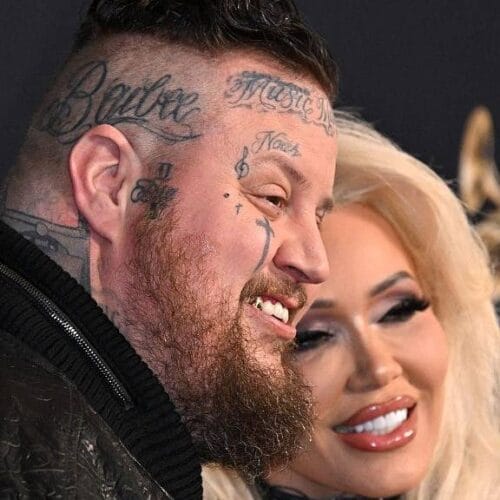 "Jelly Roll's Shocking Confession: How Major Weight Loss Took His 'Game' to a Whole New Level!"