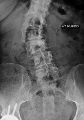 "Unlocking the Mystery: How a Splash of Stardust Makes You Heal Faster Than a Celebrity in Rehab!"