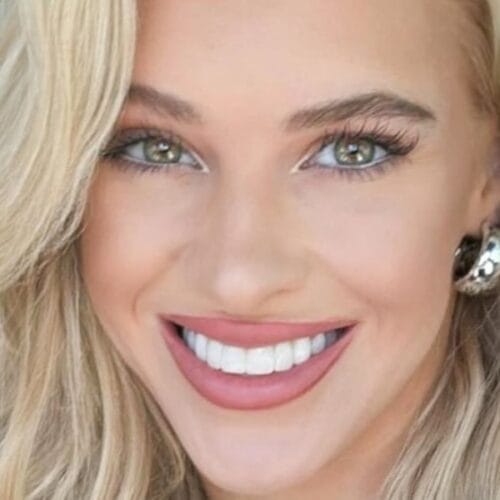 "Veronika Rajek's Unzipped Swimsuit: Are Her &lsquo;Cherries&rsquo; the Hottest New Trend for Summer?"