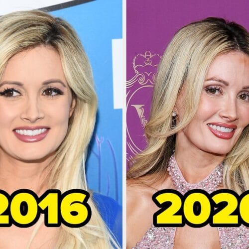 "Holly Madison Unveils Her Beauty Secrets: The Shocking Truth Behind Her Glamorous Transformation!"