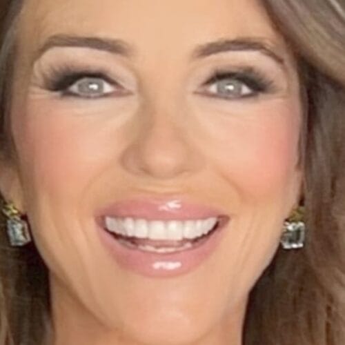 "Elizabeth Hurley Turns Back Time: You Won't Believe Her Bikini Secrets and Tropical Transformation!"