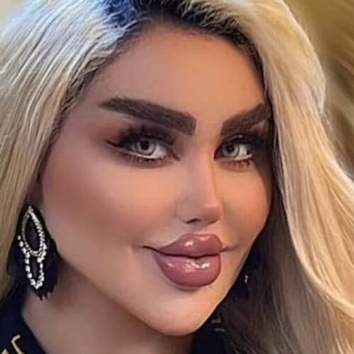 &ldquo;From Real to Real-life Doll: The Jaw-Dropping Transformation of a Woman Who Spent a Fortune to Become Barbie!&rdquo;