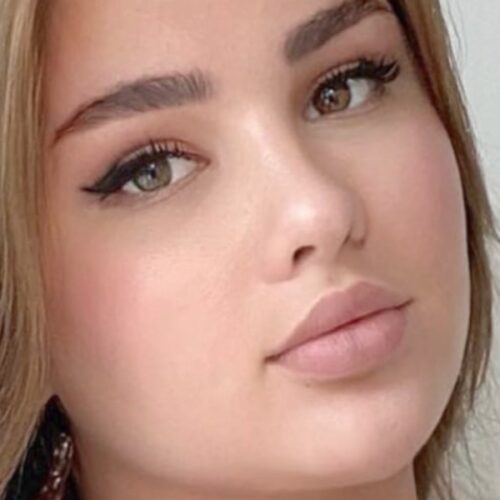"Anastasiya Kvitko’s String Bikini Sparks Debate: Do Her ‘Huge Melons’ Deserve a Trophy or Just a Double Take?"