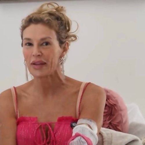 "Brandi Glanville's Heart-Wrenching Plea: Tears and Triumph in Her GoFundMe Fight Against Facial Disfigurement!"