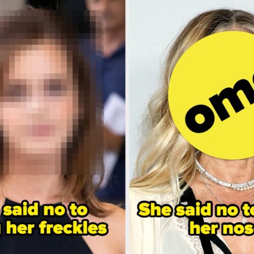 "From Flaws to Fabulous: 14 Celebs Who Said 'No Thanks!' to Cosmetic Criticism and Owned Their Unique Looks"