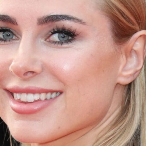 "Kimberley Garner's Stunning Slit Dress Sparks Frenzy: What She Didn't Wear Is Leaving Fans Breathless!"